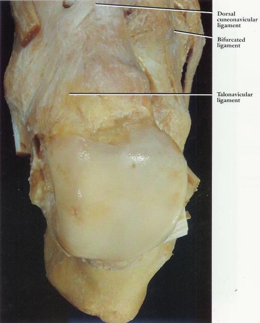 Superior aspect of the right tarsus with ligaments
