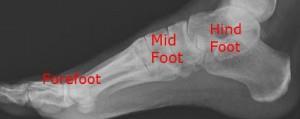 The foot is divided into 3 general regions: http://gsdimartino.