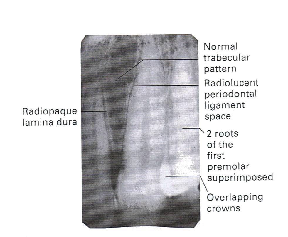 Radiographic