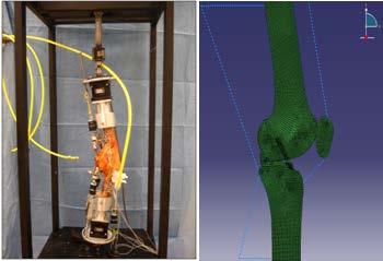 CHAPTER III Preliminary Tests A patient-specific 2-D finite element (FE) knee model was initially developed to examine relations between joint morphology, anterior-posterior tibiofemoral