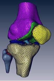 Figure 12: Segmented solid model of the knee joint 2. Meshing: To perform FEA, the solid model has to be discretized into elements (Figure 13).