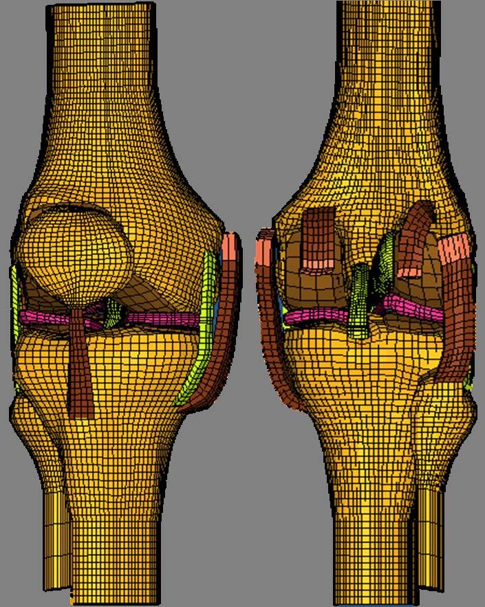 Figure 13: Meshed (discretized) 3-D knee joint model During this stage, rigid rods and plates were added to the proximal