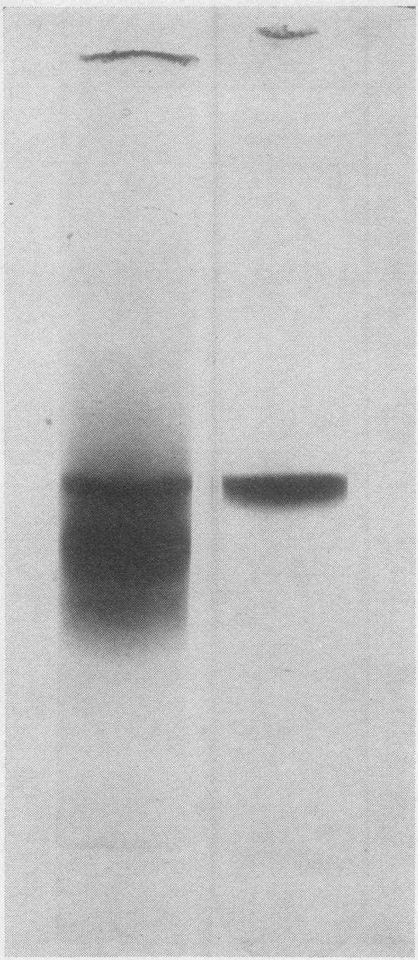 FIGURE 2 Polyacrylamide gel electrophoresis of the purified enzymes of GSH synthesis. Gel on left: 150,ug GC synthetase. Gel on right: 50 Ag GSH synthetase.