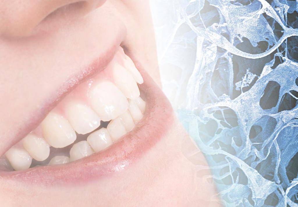 Regaining your gum tissue Soft tissue