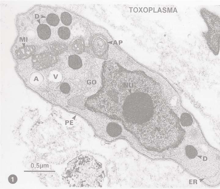 Toxoplasmosis Toxoplasma gondii Yoshifumi Nishikawa National Research Center for Protozoan