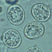 Morphology A sporulated oocyst of Toxoplasma gondii.