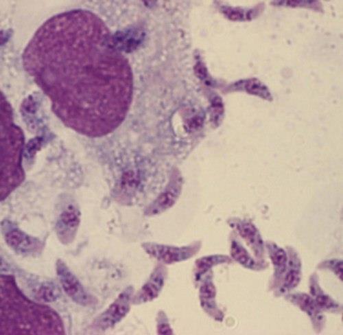 Etiology Toxoplasma gondii is an obligate intracellular