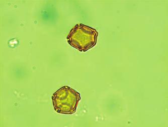 2F) and poplar belong to this family. Ulmaceae: This pollen induces pollinosis between May and June. It has a diameter of 30 to 40 µm and has five furrows and a thick, wave-like exine.