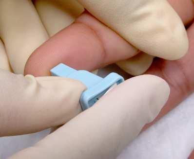 Blood Glucose Monitoring (BGM) Inserting a test strip into a blood