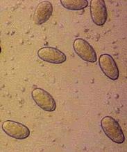 Conidia were initially hyaline, unicellular, subovoid to ellipsoidal, with a granular content (Fig. 11).
