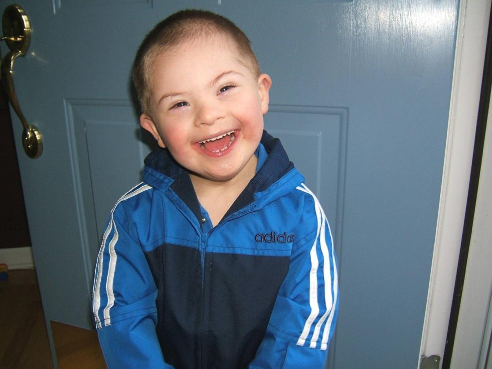 Down Syndrome Cause: Nondisjunction of
