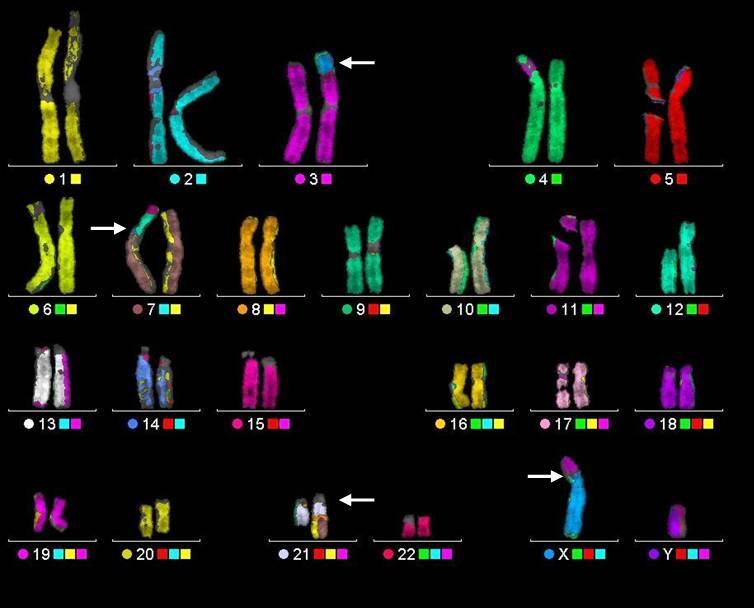 Chromosomal Translocation Material is swapped with another