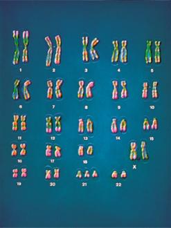 number of a par:cular chromosome n + 1 n + 1 n 1 n 1 n + 1 n 1 n n (a) of homologous chromosomes in