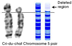 syndrome X0 female sterile it is the only known viable monosomy in humans Structurally Altered Chromosomes cri du chat (