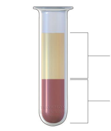 Two main components: Plasma Fluid component of blood (mostly water) Formed Elements Red blood cells (erythrocytes) Made in bone marrow Transport O 2 and CO 2 in the blood Transport nutrients and