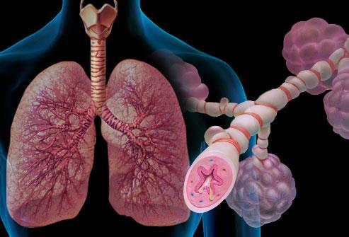 Respiratory Diseases Asthma is a disease that is characterized by spasm of the smooth muscles that line the respiratory system, an oversecretion of mucous, and swelling of the cells lining the