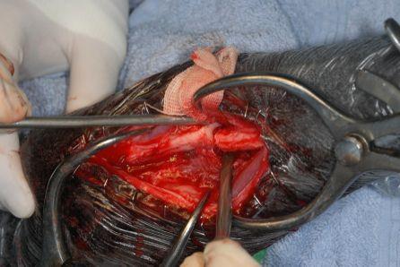 Surgery Orthogonal osteotomy,