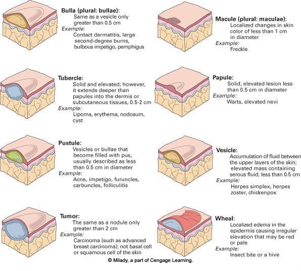 Lesions of the Skin A lesion is a mark on the skin or