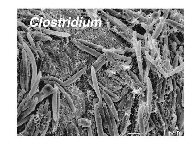 Clostridium species: promoting protection Colonized germ-free mice with 46 Clostridium species Expanded the numbers of