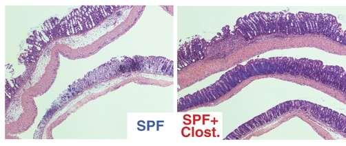 Clostridium species: promoting protection Subsets of Clostridium species thought to protect against inflammation are reduced in patients with