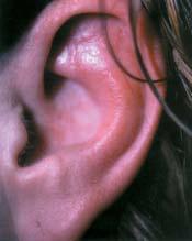 This month: 1. My ear won t stop hurting! 5. Cortisone Cream Didn t Help! 2. What are these red bumps? 6. Can my girlfriend get it? 3. Why won t this rash leave? 7. My wife noticed it! 4.