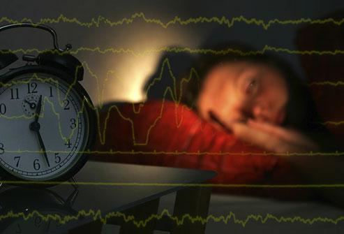 What Are Sleep Disorders? Sleep disorders are conditions that affect how much and how well you sleep.