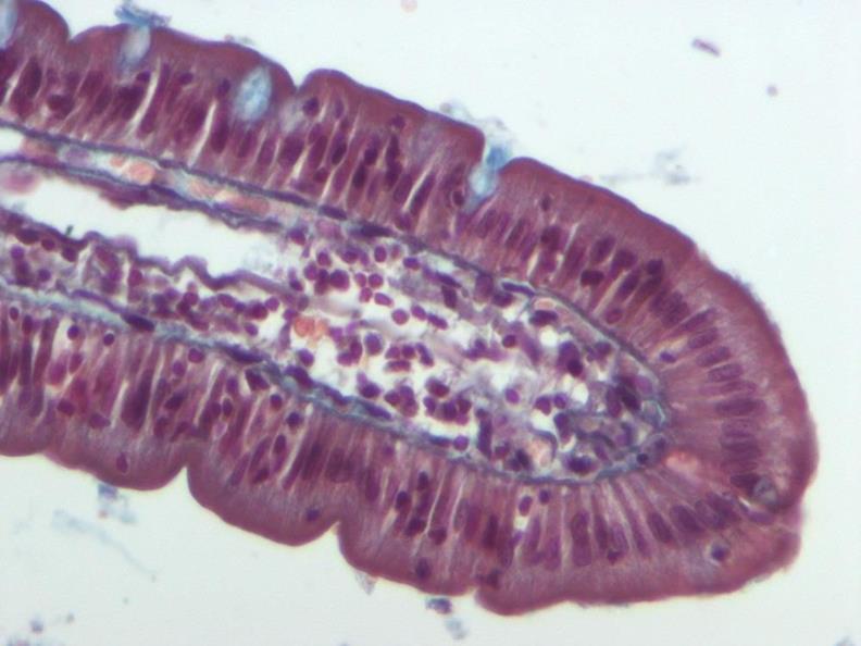 Simple Columnar epithelium Q1- Identify the type of epithelium? Simple columnar epithelium with goblet cells Goblet cells Q2- mention the organs (distribution, site & example)?