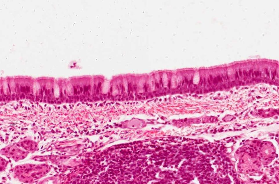 Pseudostratified Columnar epithelium ciliated with goblet cells Q1- Identify the type of epithelium?