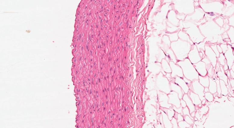 Elastic connective tissue Q1- Identify the structure?
