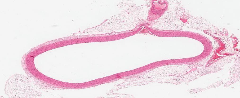 Fibroblast cells Elastic connective tissue adipose