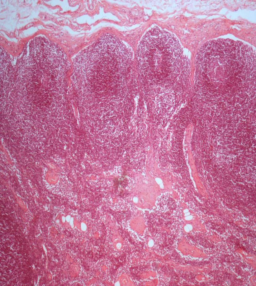 Lymph node Q1- Identify the structure?