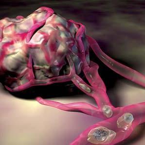 metastasis 2 Tumors shed approximately 1 million circulating tumor cells per