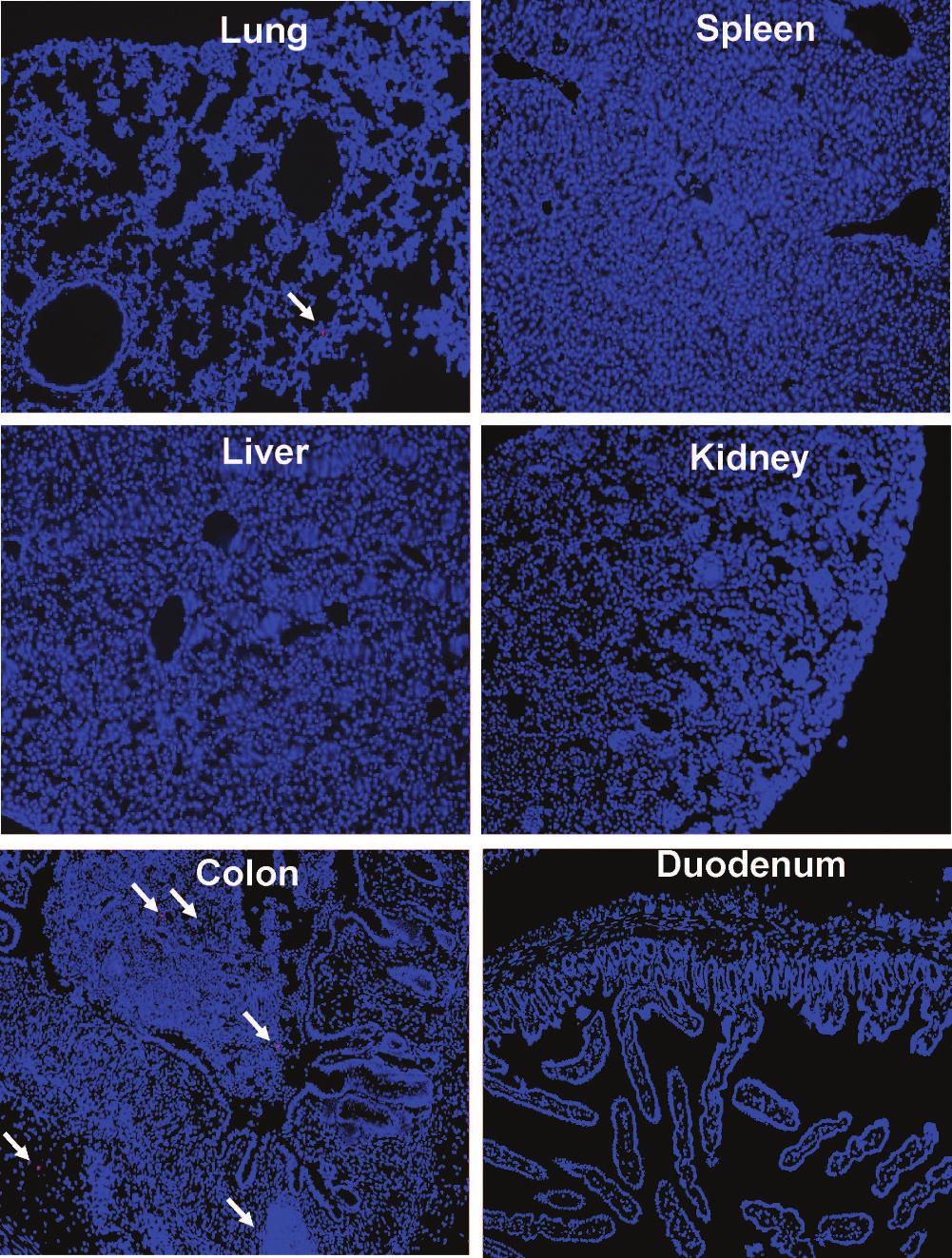 The Americn Society of Gene & Cell Therpy Dy 1 Monocyte-bsed 27B1 Gene Therpy for IBD b Dy 3 Figure 1 Engrftment of CD11b+/Gr1+ monocytes t the inﬂmed colon of mice with dextrn sulfte sodium