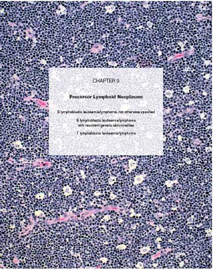 WHO Classification of Tumours of Haematopoietic and Lymphoid Tissues 4 Edition B lymphoblastic leukaemia/lymphoma, not otherwise specified B-ALL/LBL B lymphoblastic luekaemia/lymphoma, with recurrent