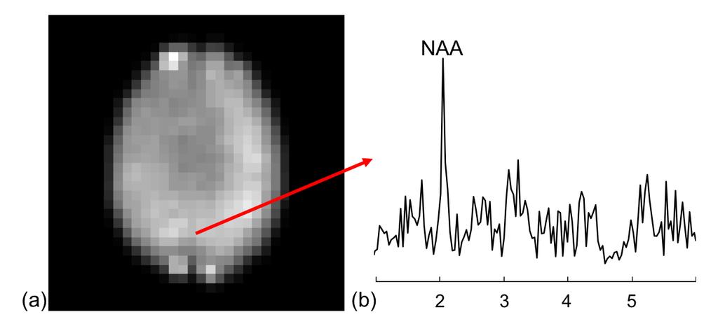 Fig. 4. (a) Whole spectral integral and (b) a typical spectrum after nuisance removal. Outer brain artifacts were masked, and a k-space truncation with a hamming window is applied.