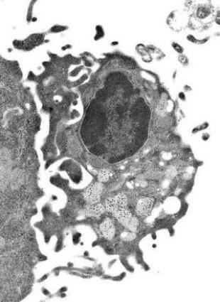 NK cells Subset of lymphocytes