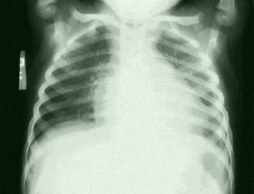 A 3-year-old with systemic