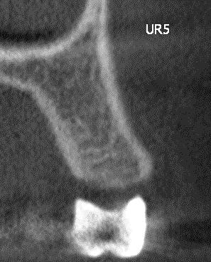 Safety and Efficacy of a New and Emerging Dental X-ray Modality 3.