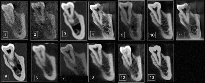 Not all CBCT machines are the same! Liang X et al.