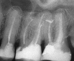 Periapical diagnosis CBCT Properly validated in vivo studies