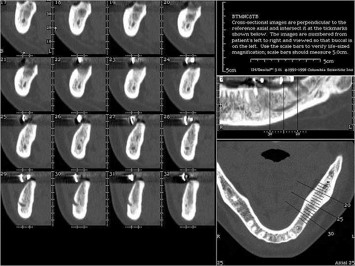 Implantology Main driver for