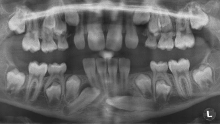 imaging method of choice is conventional dental radiography and when the