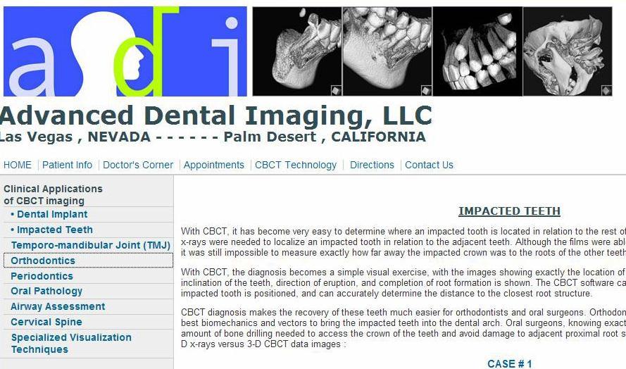 CBCT in Orthodontics: the hype NO MORE DENTAL IMPRESSIONS!