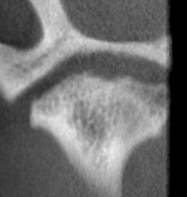 conventional CT, CBCT is indicated as an