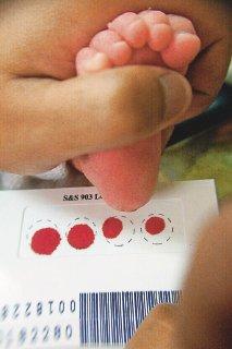 CLINICAL SEVERITY AND SCD GENOTYPES NEWBORN SCREENING IS AN IMPORTANT TOOL FOR PREDINCTING