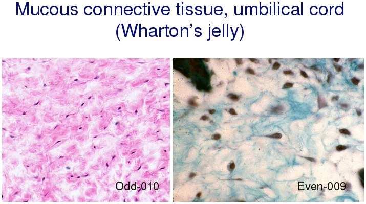 Embryonic connective tissues mucous connective tissue: found during fetal development umbilical cord (Wharton s jelly), pulp of young teeth structural very similar to mesenchyme lower capability to