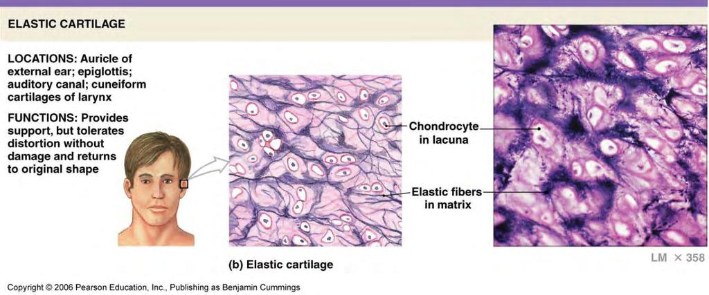Supporting CT: Cartilage Elastic Cartilage mostly