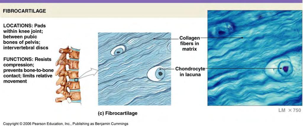Supporting CT: Cartilage Fibrocartilage Little ground substance; fewer