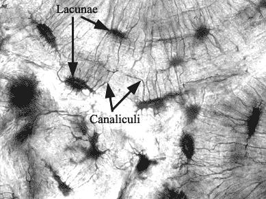 Lacunae Osteoblasts