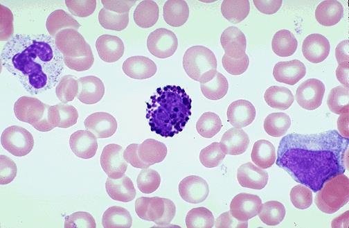 (20-25%) B & T cells Granulocytes